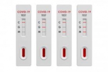 COVID-19 TESTIRANJE